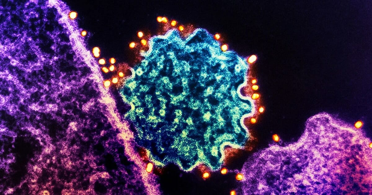 Brote del virus Nipah: lo que saben los científicos sobre el peligroso patógeno detectado en la India