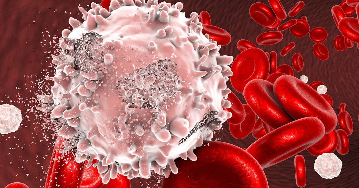 La salud de Wanda Nara: qué es la leucemia, el cáncer que se origina en la médula ósea
