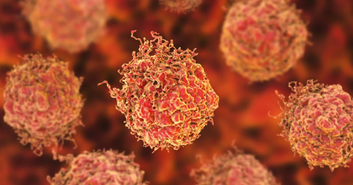 Qué mutaciones genéticas podrían cambiar el tratamiento del cáncer de próstata