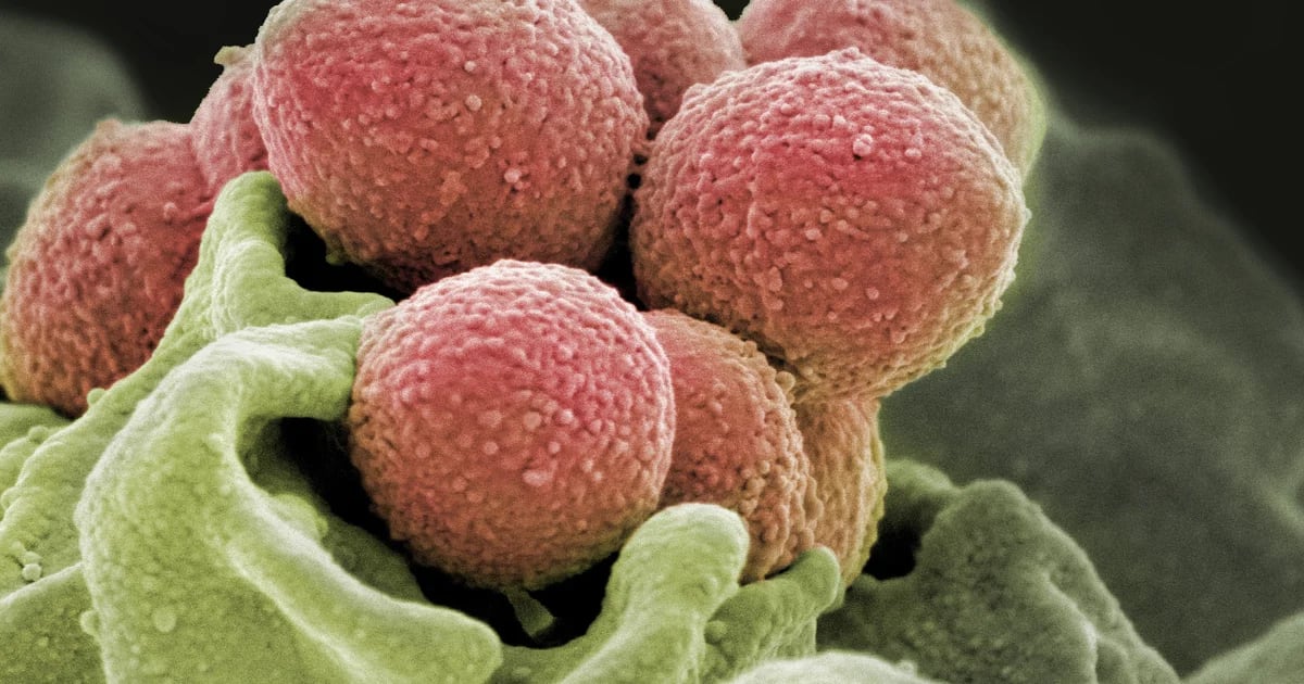 Streptococcus Pyogenes, por qué la bacteria que causa la faringitis ahora causa síntomas más graves