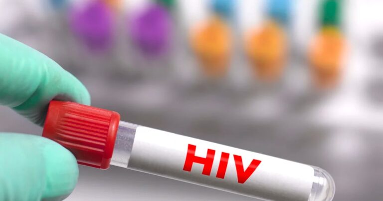 Diferencias entre VIH y SIDA: la importancia del diagnóstico precoz para lograr una carga viral indetectable